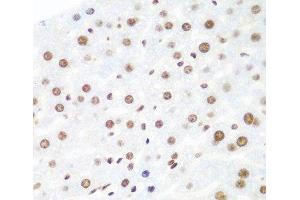 Immunohistochemistry of paraffin-embedded Mouse liver using Argonaute-2 Polyclonal Antibody at dilution of 1:100 (40x lens).
