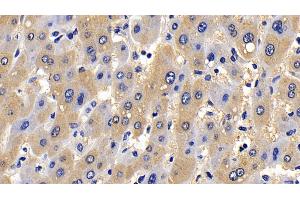 Immunohistochemistry (IHC) image for anti-BH3 Interacting Domain Death Agonist (BID) (AA 1-195) antibody (ABIN7432259)