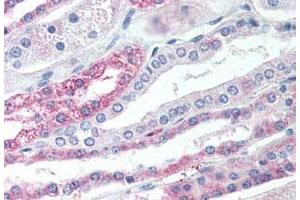 Immunohistochemistry (Formalin/PFA-fixed paraffin-embedded sections) of human kidney tissue with GPBAR1 polyclonal antibody .
