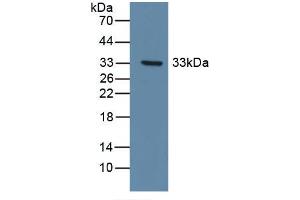 Detection of Recombinant DDR1, Human using Polyclonal Antibody to Discoidin Domain Receptor Family, Member 1 (DDR1) (DDR1 Antikörper  (AA 568-829))