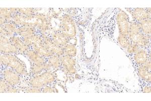 Detection of DNASEII in Human Kidney Tissue using Polyclonal Antibody to Deoxyribonuclease II (DNASEII) (Deoxyribonuclease II (AA 19-360) Antikörper)