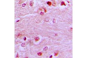 Immunohistochemical analysis of EZH1 staining in human brain formalin fixed paraffin embedded tissue section. (EZH1 Antikörper  (Center))