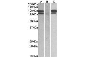 HEK293 lysate (10 µg protein in RIPA buffer) overexpressing Human PCSK9 with C-terminal MYC tag probed with AP22407PU-N (0. (PCSK9 Antikörper  (Internal Region))