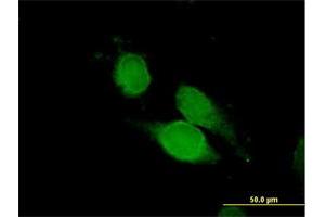 Immunofluorescence of purified MaxPab antibody to NCK1 on HeLa cell. (NCK1 Antikörper  (AA 1-377))