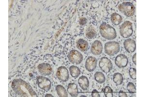 Image no. 1 for anti-Interleukin 37 (IL37) (AA 1-219) antibody (ABIN599218) (IL-37 Antikörper  (AA 1-219))