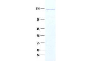 Western Blotting (WB) image for Oxidation Resistance 1 (OXR1) protein (His tag) (ABIN2728072)