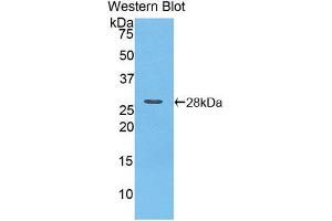 Western blot analysis of the recombinant protein. (iPLA2 Antikörper  (AA 481-702))