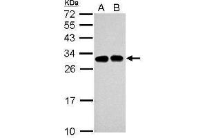 WB Image Sample (30 ug of whole cell lysate) A: Jurkat B: Raji 12% SDS PAGE antibody diluted at 1:5000 (SLC25A11 Antikörper)