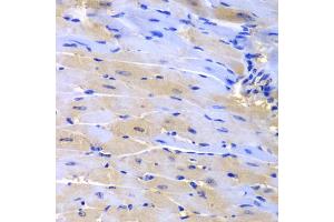 Immunohistochemistry of paraffin-embedded mouse heart using CUL2 antibody (ABIN5975808) at dilution of 1/200 (40x lens). (Cullin 2 Antikörper)