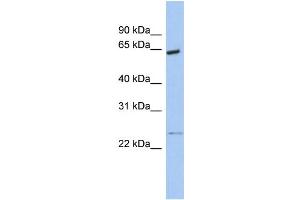 WB Suggested Anti-PCTK1 Antibody Titration:  0. (CDK16 Antikörper  (N-Term))
