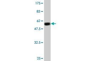 Western Blot detection against Immunogen (51. (TK1 Antikörper  (AA 1-234))