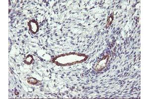 Image no. 2 for anti-Family with Sequence Similarity 84, Member B (FAM84B) antibody (ABIN1498212) (FAM84B Antikörper)