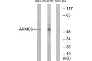 Western blot analysis of extracts from HeLa/COLO cells, using ARMC6 Antibody. (ARMC6 Antikörper  (AA 431-480))