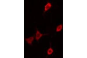 ABIN6276361 staining  A2780 cells by IF/ICC. (CDKN1B Antikörper  (Internal Region))