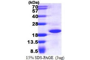 SDS-PAGE (SDS) image for CGRP Receptor Component (CRCP) (AA 1-148) protein (His tag) (ABIN667542)