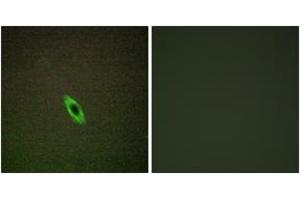 Immunofluorescence analysis of HepG2 cells, using GRAA Antibody.