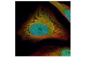 ICC/IF Image Confocal immunofluorescence analysis (Olympus FV10i) of paraformaldehyde-fixed HeLa, using Flightless I, antibody (Green) at 1:500 dilution. (Flightless I Antikörper  (Internal Region))