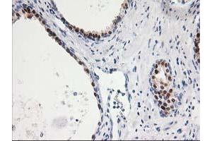 Immunohistochemical staining of paraffin-embedded Human prostate tissue using anti-SMS mouse monoclonal antibody. (SMS Antikörper)