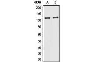 Western blot analysis of TIF1 alpha expression in MCF7 (A), HeLa (B) whole cell lysates.
