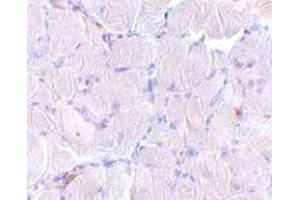 Immunohistochemical staining of human skeletal muscle tissue with 10 ug/mL SCARB2 polyclonal antibody . (SCARB2 Antikörper  (C-Term))
