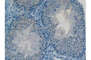 DAB staining on IHC-P; Samples: Mouse Testis Tissue (C2CD3 Antikörper  (AA 2051-2323))