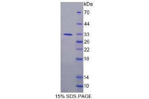 SDS-PAGE analysis of Human FPGT Protein. (FPGT Protein)