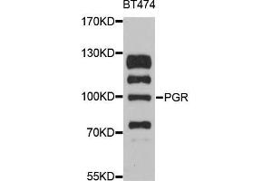 Western blot analysis of extracts of BT-474 cells, using PGR antibody (ABIN5998504) at 1:3000 dilution. (Progesterone Receptor Antikörper)