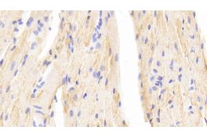 Detection of b2M in Mouse Cardiac Muscle Tissue using Polyclonal Antibody to Beta-2-Microglobulin (b2M) (beta-2 Microglobulin Antikörper  (AA 22-119))