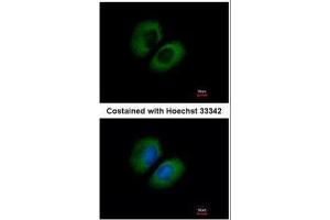 ICC/IF Image Immunofluorescence analysis of methanol-fixed A549, using CACNA1B, antibody at 1:500 dilution.