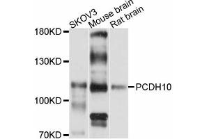 Western blot analysis of extracts of various cell lines, using PCDH10 antibody (ABIN5998466) at 1:3000 dilution. (PCDH10 Antikörper)
