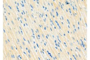 ABIN6263352 and ABIN6273268 at 1/100 staining Rat heart tissue by IHC-P. (MRFAP1 Antikörper  (Internal Region))