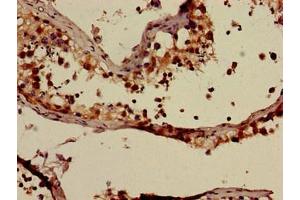 Immunohistochemistry of paraffin-embedded human testis tissue using ABIN7144908 at dilution of 1:100 (ABCC9 Antikörper  (AA 560-669))