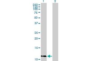 IFI27 Antikörper  (AA 1-119)