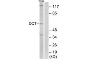 Western blot analysis of extracts from K562 cells, using DCT Antibody. (DCT Antikörper  (AA 51-100))