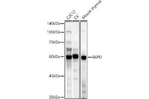 Western blot analysis of extracts of various cell lines, using G6PD antibody (ABIN3022094, ABIN3022095, ABIN3022096 and ABIN6218601) at 1:1000 dilution. (Glucose-6-Phosphate Dehydrogenase Antikörper  (AA 246-545))