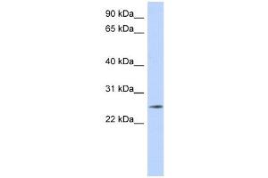 NKAIN4 antibody used at 1 ug/ml to detect target protein. (NKAIN4 Antikörper  (Middle Region))