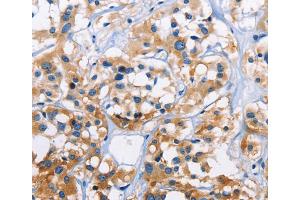 Immunohistochemistry (IHC) image for anti-Capping Protein (Actin Filament) Muscle Z-Line, alpha 3 (CAPZA3) antibody (ABIN2423053) (CAPZA3 Antikörper)