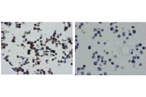 Immunohistochemistry (IHC) image for anti-Tumor Necrosis Factor (Ligand) Superfamily, Member 13b (TNFSF13B) antibody (ABIN1449224) (BAFF Antikörper)