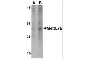 Western blot analysis of MettL7B in Jurkat lysate with this product at (A) 2 and (B) 4 μg/ml. (METTL7B Antikörper  (N-Term))