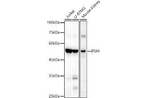 Western blot analysis of extracts of various cell lines, using IFI44 antibody (ABIN6135120, ABIN6142168, ABIN6142169 and ABIN6224213) at 1:1000 dilution. (IFI44 Antikörper)