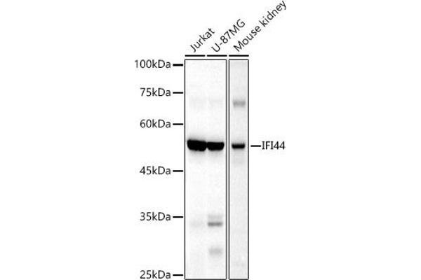 IFI44 Antikörper