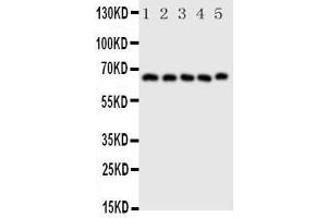 Western Blotting (WB) image for anti-Prostaglandin-Endoperoxide Synthase 2 (Prostaglandin G/H Synthase and Cyclooxygenase) (PTGS2) (AA 589-604), (C-Term) antibody (ABIN3044296)