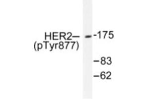 Image no. 1 for anti-Receptor tyrosine-protein kinase erbB-2 (ErbB2/Her2) (pTyr877) antibody (ABIN318038) (ErbB2/Her2 Antikörper  (pTyr877))
