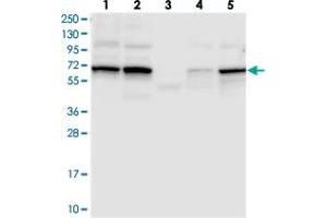 Western blot analysis of Lane 1: RT-4, Lane 2: U-251 MG, Lane 3: Human Plasma, Lane 4: Liver, Lane 5: Tonsil with TCHP polyclonal antibody  at 1:250-1:500 dilution. (TCHP Antikörper)