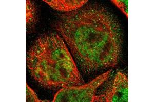 Immunofluorescent staining of A-431 cells with ACSS2 polyclonal antibody  (Green) shows positivity in cytoplasm, vesicles and nucleus but excluded from the nucleoli. (ACSS2 Antikörper)
