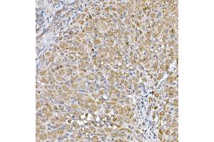 Immunohistochemistry of paraffin-embedded rat ovary using Niemann Pick C1 Rabbit mAb (ABIN7268911) at dilution of 1:50 (40x lens).