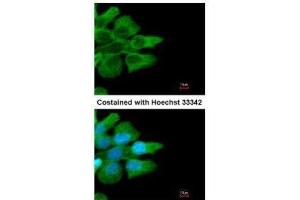 ICC/IF Image Immunofluorescence analysis of methanol-fixed A431, using CD32B, antibody at 1:500 dilution. (FCGR2B Antikörper  (C-Term))