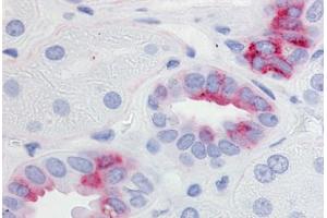 anti-Prostaglandin E Receptor 2 (Subtype EP2), 53kDa (PTGER2) (Cytoplasmic Domain) antibody