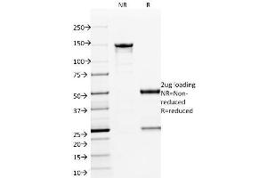 SDS-PAGE Analysis Purified ETS1 Mouse Monoclonal Antibody (ETS1/1801).