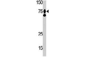 The HGF polyclonal antibody  is used in Western blot to detect HGF in Ramos cell lysate.